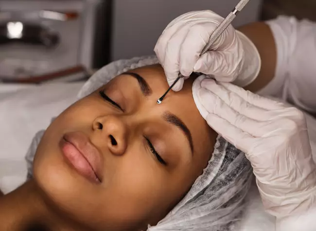 woman receiving an acne treatment